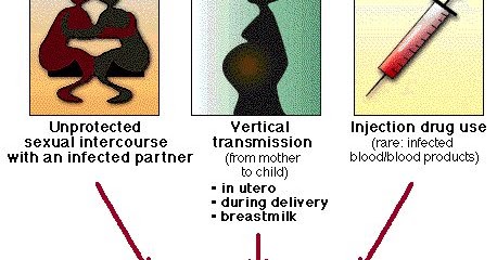 hiv-lay-nhiem-qua-uong-nao